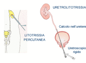 migliore clinica di urologia a Lecco